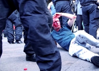 מהומות גזעיות קשות בלונדון. אלימות קשה בין שחורים ללבנים. אין ליסוע לשם עוד: